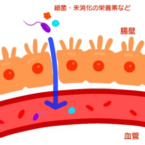 喫煙と腸活、リーキーガット症候群について。